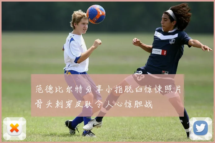 范德比尔特分享小指脱臼惊悚照片骨头刺穿皮肤令人心惊胆战